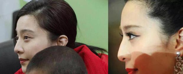 Phạm Băng Băng véo mũi nặn mụn xóa tan nghi vấn phẫu thuật thẩm mỹ-3