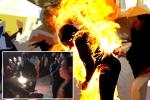 Thái Bình: Mâu thuẫn gia đình, vợ bị chồng đốt cháy ngùn ngụt, bỏng đến 90%