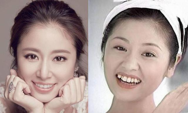 Giật mình với những hàm răng khấp khểnh kém duyên của sao Hoa ngữ-1