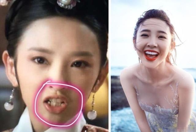 Giật mình với những hàm răng khấp khểnh kém duyên của sao Hoa ngữ-3