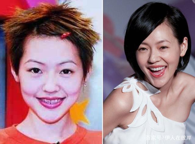 Giật mình với những hàm răng khấp khểnh kém duyên của sao Hoa ngữ-4