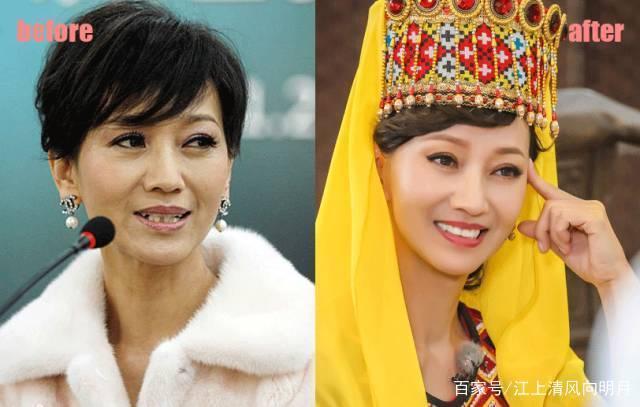 Giật mình với những hàm răng khấp khểnh kém duyên của sao Hoa ngữ-6