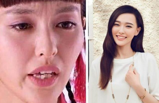 Giật mình với những hàm răng khấp khểnh kém duyên của sao Hoa ngữ-7