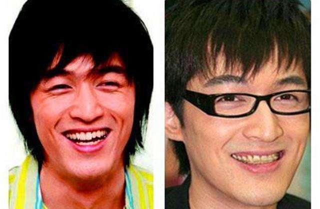 Giật mình với những hàm răng khấp khểnh kém duyên của sao Hoa ngữ-8