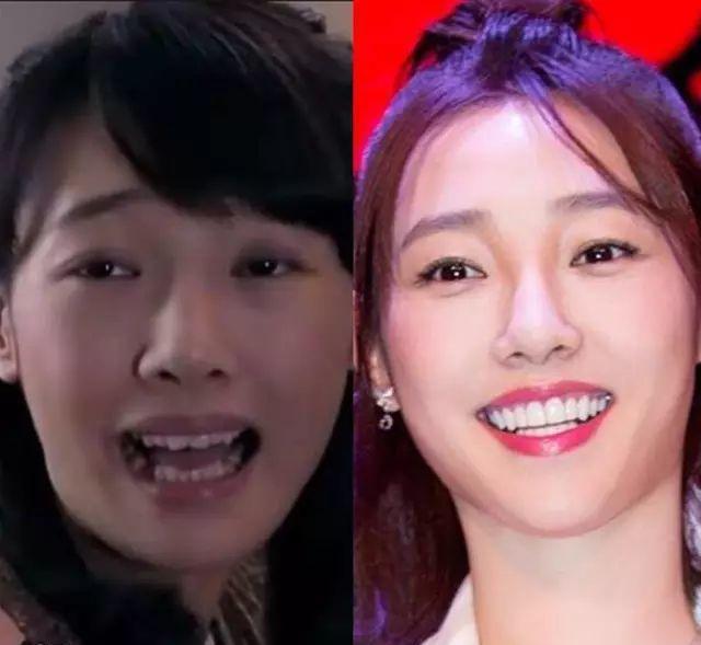 Giật mình với những hàm răng khấp khểnh kém duyên của sao Hoa ngữ-9