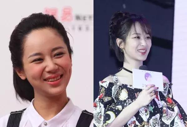 Giật mình với những hàm răng khấp khểnh kém duyên của sao Hoa ngữ-10