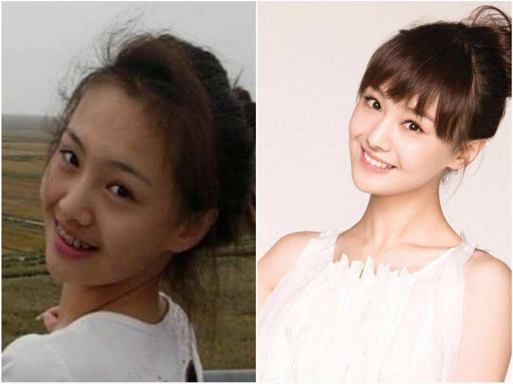 Giật mình với những hàm răng khấp khểnh kém duyên của sao Hoa ngữ-12