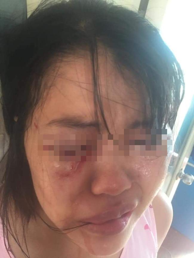 Nữ nhân viên điều hành taxi ở Hà Nội tố bị chồng bạo hành dã man-1