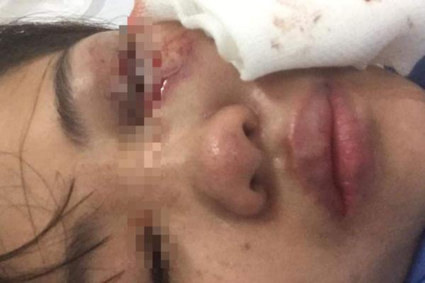 Clip: Người đàn ông bị vợ và con trai trói tay chân, dùng dép vả liên tiếp vào mặt ở Hà Nội-4