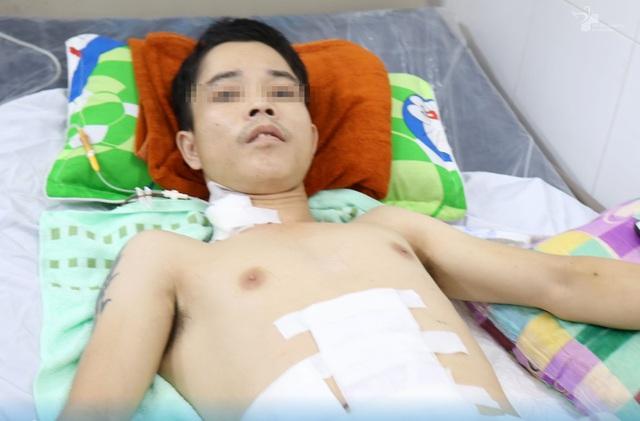 Nam công nhân bị đâm thủng ruột, xuyên qua dạ dày và gan-1