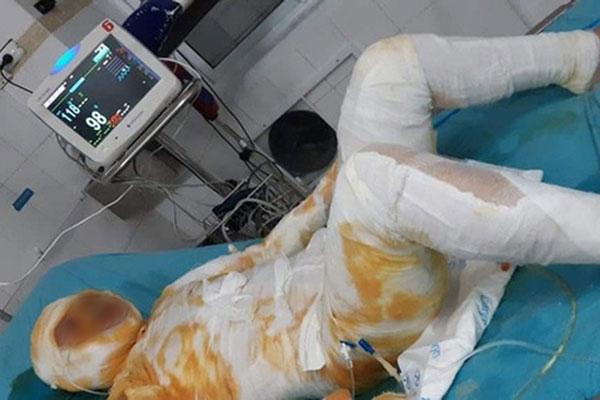 Khởi tố người chồng đổ xăng đốt vợ-1