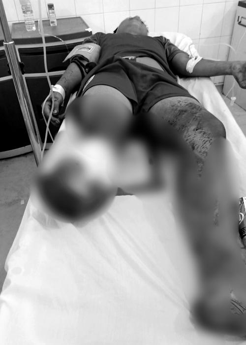 Kinh hãi: Thiếu nhiên 15 tuổi ở Tây Ninh bị chém đứt lìa chân, ướp đá mang đi cấp cứu-3