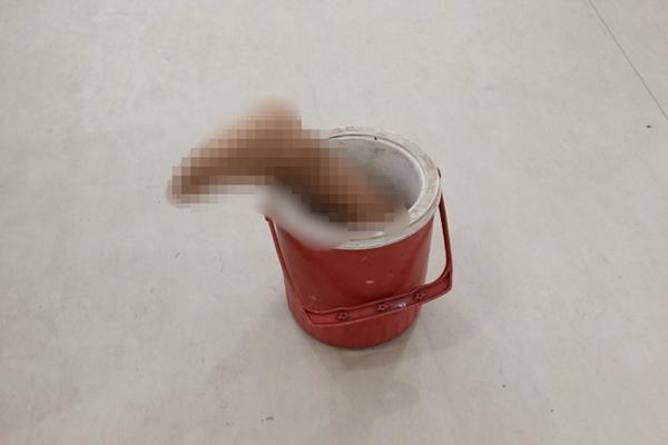 Kinh hãi: Thiếu nhiên 15 tuổi ở Tây Ninh bị chém đứt lìa chân, ướp đá mang đi cấp cứu-2