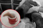 Kinh hãi: Thiếu nhiên 15 tuổi ở Tây Ninh bị chém đứt lìa chân, ướp đá mang đi cấp cứu