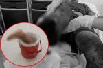 Vụ thiếu niên 15 tuổi ở Tây Ninh bị chém đứt lìa chân: 1 nghi phạm ra đầu thú-2