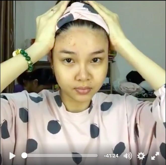 Kỳ Hân khổ sở che giấu sự xuống sắc trong thai kỳ nhưng vẫn bị bóc mẽ-7