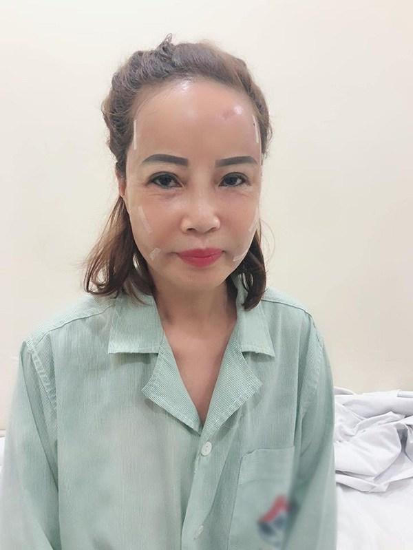 Hai hiện tượng mạng xã hội nổi tiếng với câu chuyện dao kéo: Liệu đâu là điểm dừng?-2