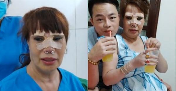 Hai hiện tượng mạng xã hội nổi tiếng với câu chuyện dao kéo: Liệu đâu là điểm dừng?-5