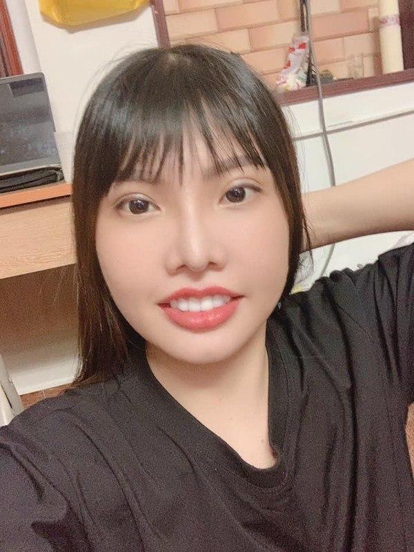 Hai hiện tượng mạng xã hội nổi tiếng với câu chuyện dao kéo: Liệu đâu là điểm dừng?-7