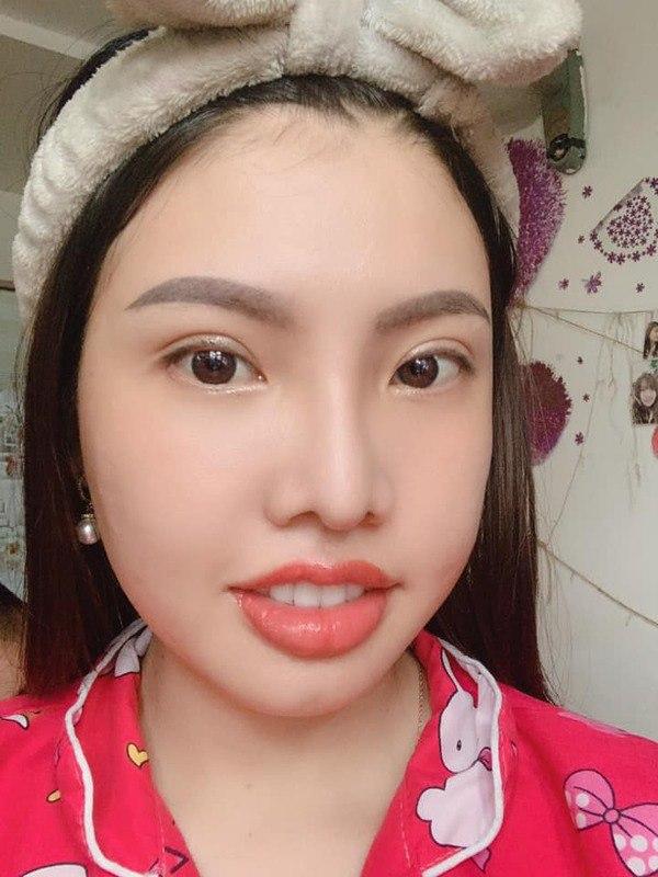 Hai hiện tượng mạng xã hội nổi tiếng với câu chuyện dao kéo: Liệu đâu là điểm dừng?-9