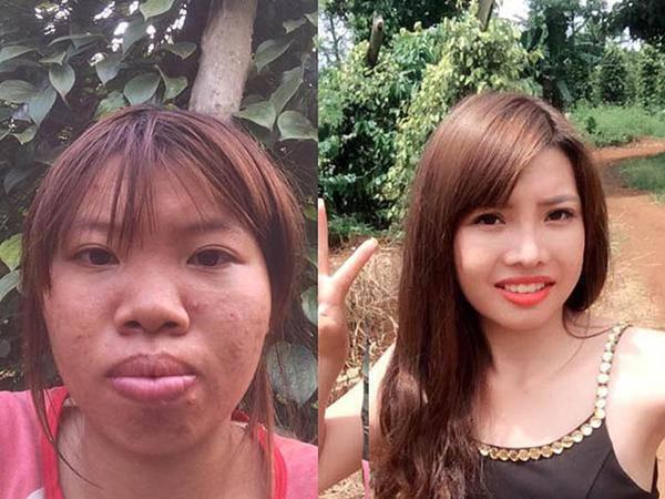 Hai hiện tượng mạng xã hội nổi tiếng với câu chuyện dao kéo: Liệu đâu là điểm dừng?-10