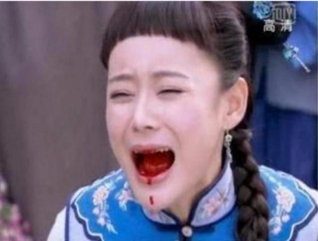 Cảnh hộc máu của Viên San San trong "Cung Tỏa Liên Thành" từng biến thành trò cười cho cộng đồng mạng. Biểu cảm đau khổ nhưng lại cười cùng miệng đầy máu của Viên San San bị đánh giá là làm lố và trông giống cảnh hài hơn.