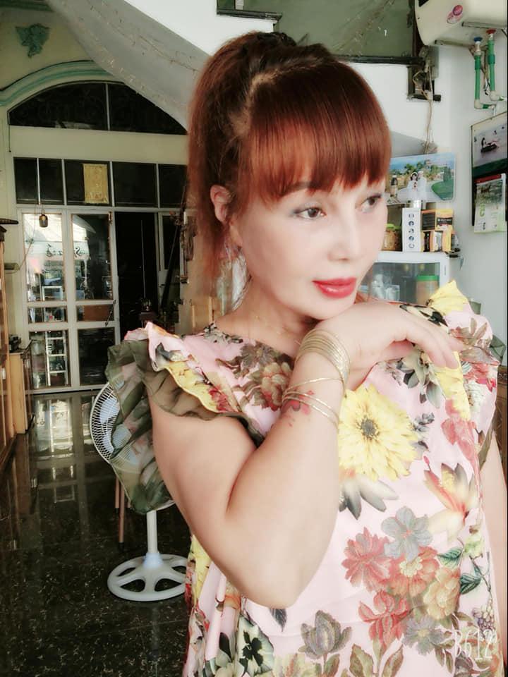 Tròn 2 tháng dao kéo, cô dâu Cao Bằng vẫn để lộ gương mặt méo lệch đáng thất vọng-3