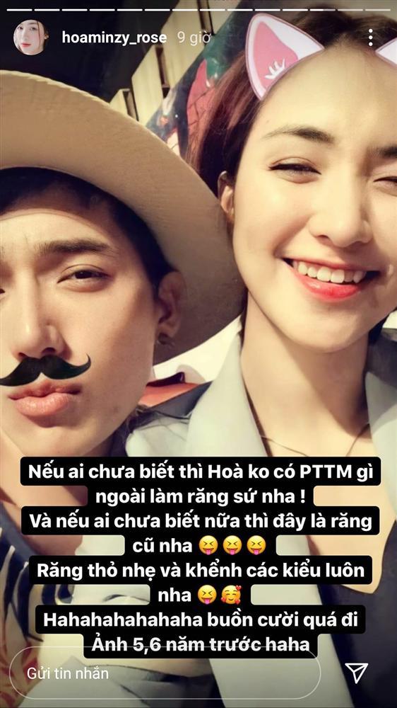 Hòa Minzy thừa nhận can thiệp thẩm mỹ-1