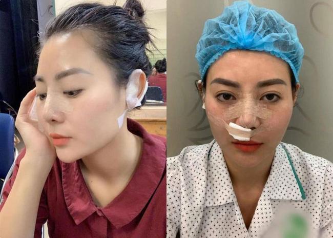 Lan Cave Thanh Hương cảnh cáo Facebooker đăng ảnh mình mặt rỗ-7