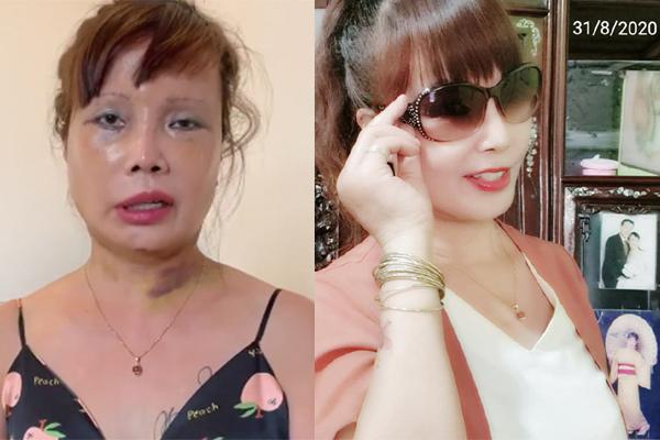 Bị chỉnh ảnh khiến mặt dị dạng, cô dâu 63 tuổi: Càng ném đá tôi càng được nhiều tiền-5