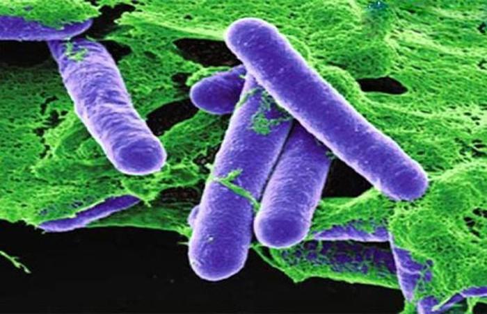 Độc tố botulinum trong pate Minh Chay ủ bao lâu thì phát bệnh?-2