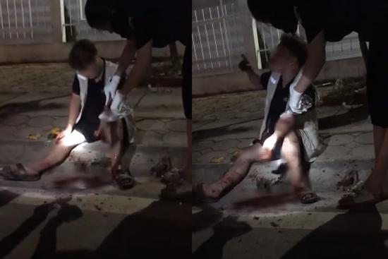 Biến căng lúc nửa đêm: Thanh niên cắt tay tự tử sau khi uống rượu vì thất tình