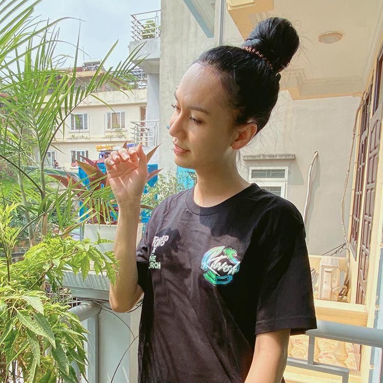 Lynk Lee chi 200 triệu đại phẫu cắt gọn da mặt nhưng vẫn không che nổi vầng trán sân bay-3