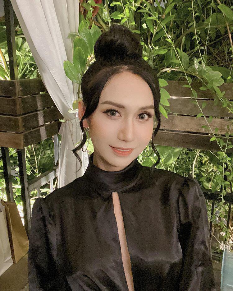 Lynk Lee chi 200 triệu đại phẫu cắt gọn da mặt nhưng vẫn không che nổi vầng trán sân bay-4