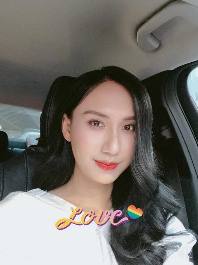 Lynk Lee chi 200 triệu đại phẫu cắt gọn da mặt nhưng vẫn không che nổi vầng trán sân bay-5