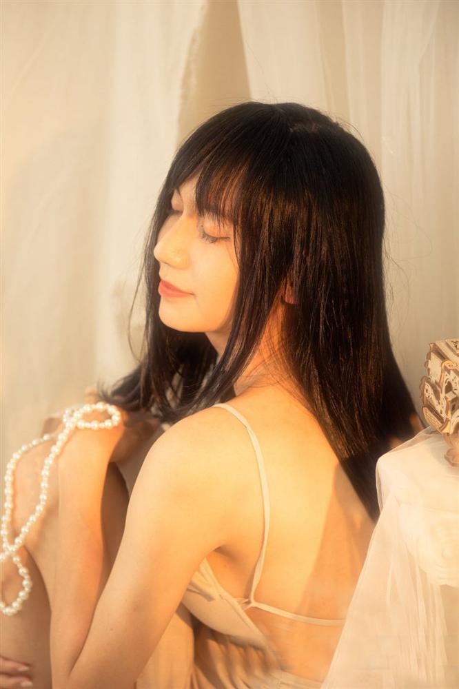 Lynk Lee chi 200 triệu đại phẫu cắt gọn da mặt nhưng vẫn không che nổi vầng trán sân bay-7