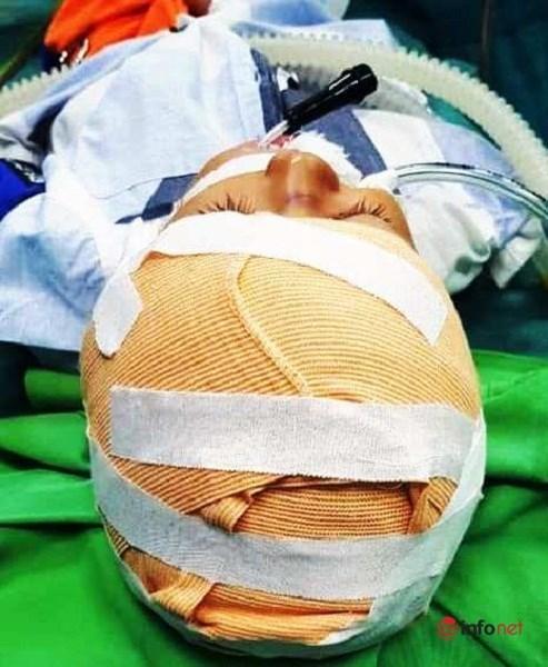 Kinh hoàng cháu bé 5 tuổi bị chó cắn rách da đầu ở Nghệ An-2