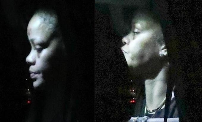 Rihanna thâm tím mặt vì ngã xe máy điện-1