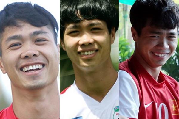 Công Phượng lộ bộ nhá tranh nhau làm tiền đạo trước khi niềng răng-1