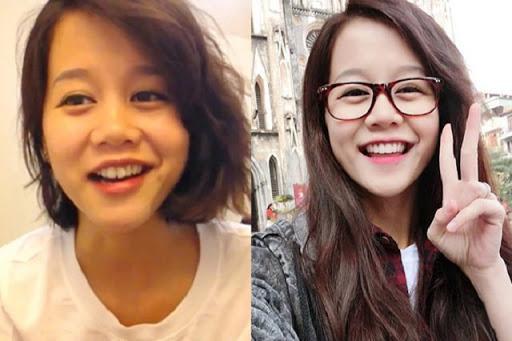 Công Phượng lộ bộ nhá tranh nhau làm tiền đạo trước khi niềng răng-10