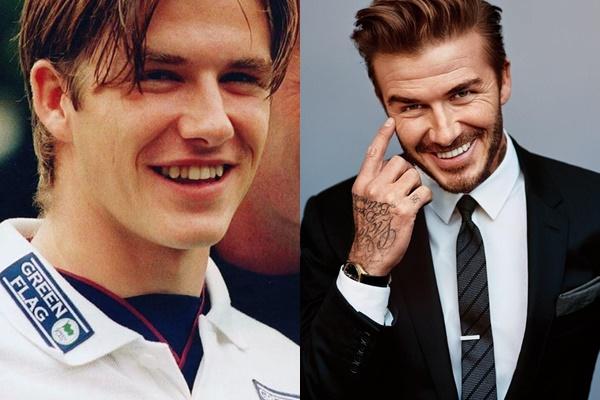 Công Phượng lộ bộ nhá tranh nhau làm tiền đạo trước khi niềng răng-6