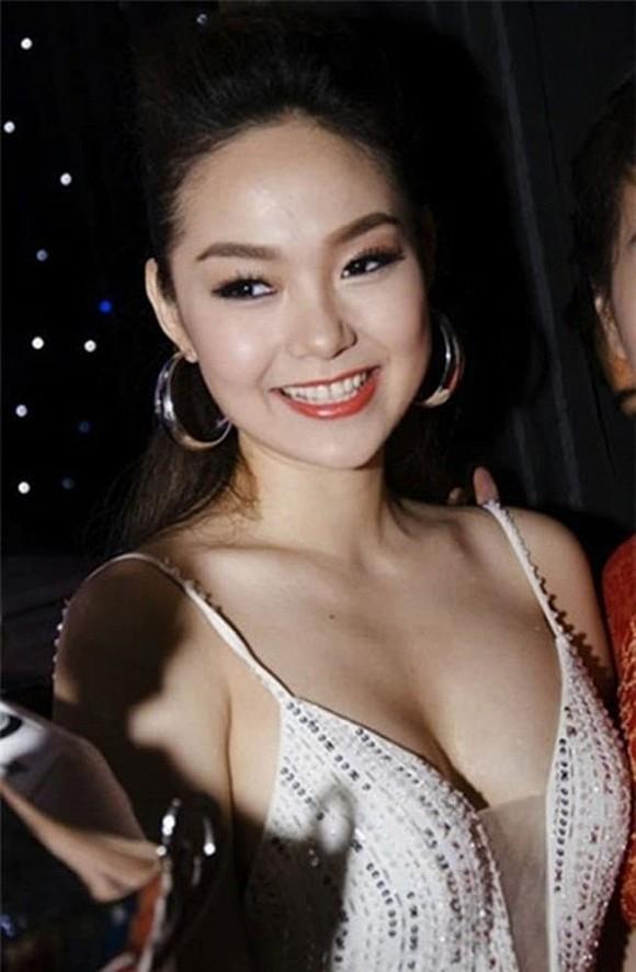 Nốt ruồi ở ngực phú quý thế nào mà Trọng Hưng bóc phốt vợ cũ Âu Hà My làm giả?-8