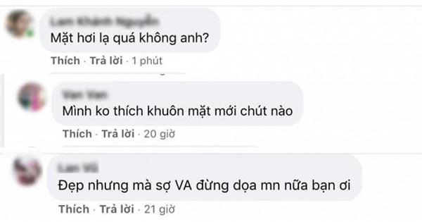 Gương mặt thẩm mỹ của Việt Anh bị chê lạ hoắc, dọa người-3