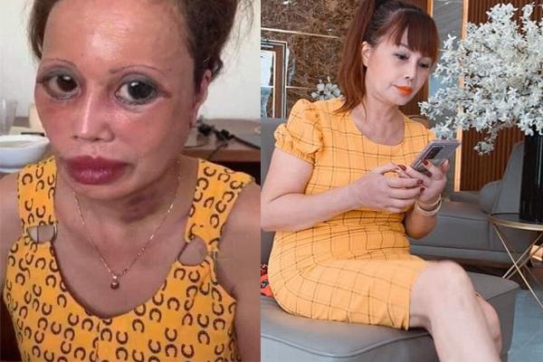 Tình tứ bên chồng ngày sinh nhật, cô dâu 63 tuổi bị xỉa xói: Ngoại hình ngày càng méo mó-6