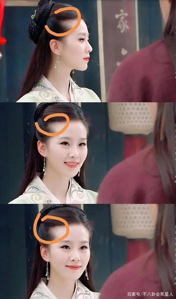 Lưu Thi Thi bị phát hiện hói sớm-1