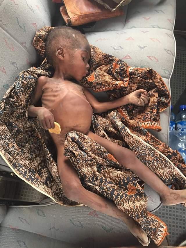 Cuộc sống sung túc hiện tại của cậu bé Châu Phi da bọc xương từng chấn động thế giới-2