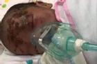 Yên Bái: Đau xót bé sơ sinh bị bỏ rơi ở ven đường có nhiều vết xước trên mặt
