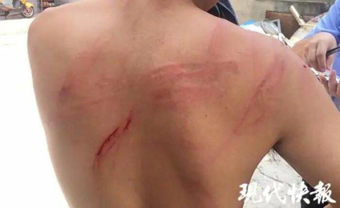 Chồng bị vợ cầm chổi đánh nát lưng, khi biết nguyên nhân ai cũng thốt lên: Bị đánh là đáng lắm-2