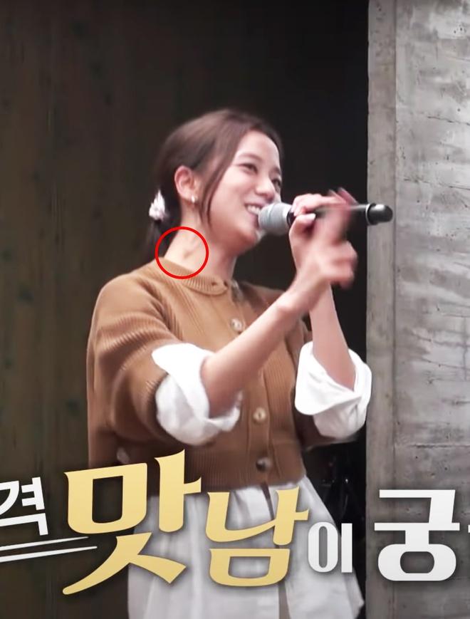 Hạch bạch huyết ở cổ Jisoo sưng to bất thường-1