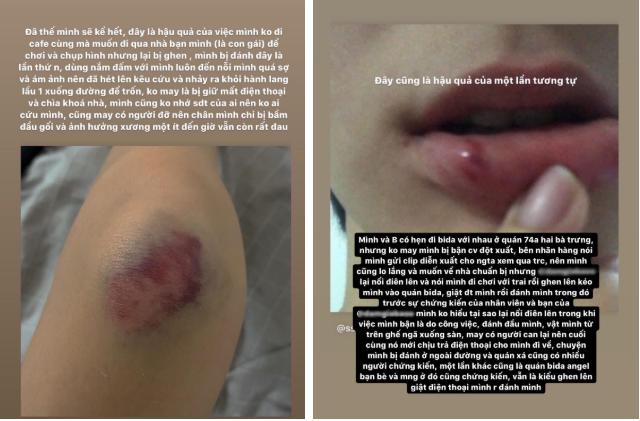 Xôn xao mẫu nữ 20 tuổi bị bạn trai hành hung do ghen tuông, chia tay rồi vẫn chửi bới bạn gái cũ trên MXH?-2